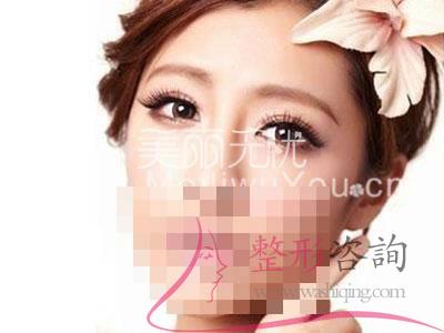 <a href=http://www.bolangguoji.com/listinfo-724-0.html target=_blank class=infotextkey>雙眼皮</a>,<a href=http://www.bolangguoji.com/listinfo-724-0.html target=_blank class=infotextkey>雙眼皮</a>整形手術