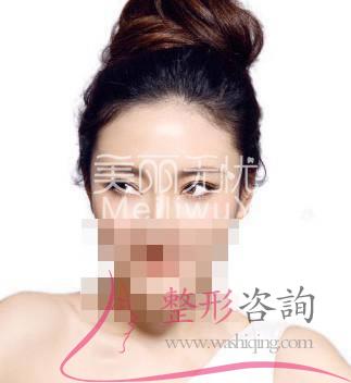 割<a href=http://www.bolangguoji.com/listinfo-724-0.html target=_blank class=infotextkey>雙眼皮</a>