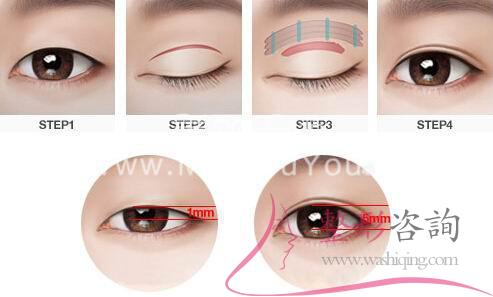<a href=http://www.bolangguoji.com/listinfo-724-0.html target=_blank class=infotextkey>雙眼皮</a>術前設計方案：哪些形狀<a href=http://www.bolangguoji.com/listinfo-724-0.html target=_blank class=infotextkey>雙眼皮</a>好看