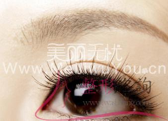 單眼皮,<a href=http://www.bolangguoji.com/listinfo-724-0.html target=_blank class=infotextkey>雙眼皮</a>