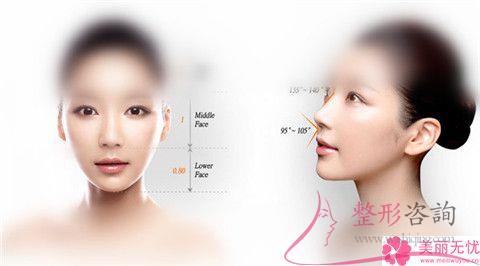<a href=http://www.bolangguoji.com/listinfo-754-0.html target=_blank class=infotextkey>鼻翼</a>縮小手術(shù)之后會(huì)否遺留下傷疤