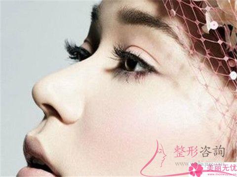 <a href=http://www.bolangguoji.com/listinfo-754-0.html target=_blank class=infotextkey>鼻翼</a>縮小手術(shù)之后會(huì)否遺留下傷疤