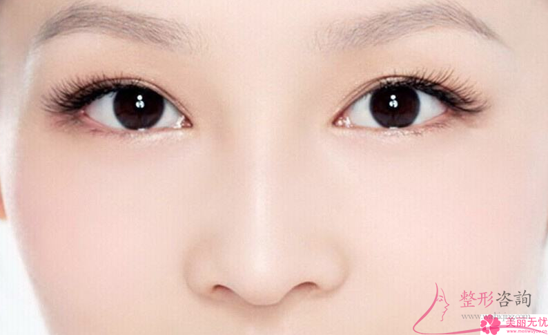 <a href=http://www.bolangguoji.com/listinfo-711-0.html target=_blank class=infotextkey>開眼角</a>得到的效果能夠持續25年嗎