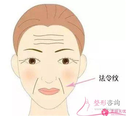 怎么樣徹底去除法令紋？指壓方法能<a href=http://www.bolangguoji.com/listinfo-780-0.html target=_blank class=infotextkey>去魚尾紋</a>嗎？
