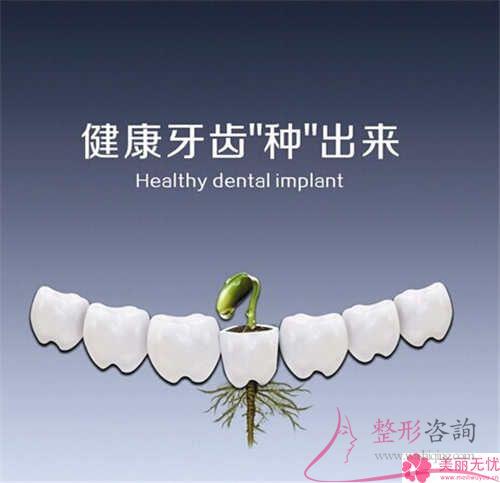 種植牙常見的種植牙材料有什么