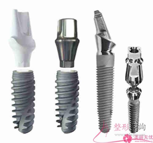 種植牙的種植體常規(guī)的種植牙材料都有幾個(gè)？?jī)r(jià)錢要多少