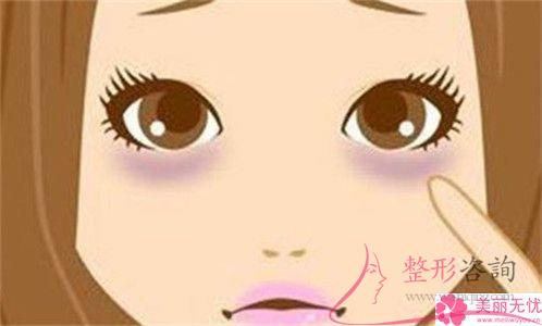 是不是種植睫毛(Eyelash planting)數量越多價格就越高