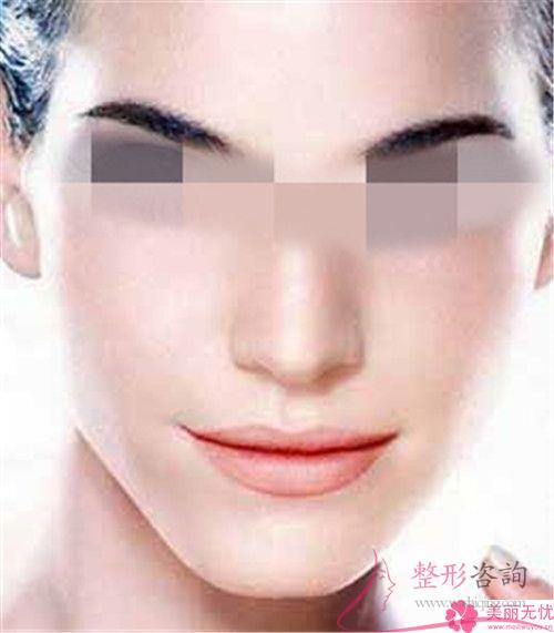 <a href=http://www.bolangguoji.com/listinfo-612-0.html target=_blank class=infotextkey>面部提升</a>適合哪些人群