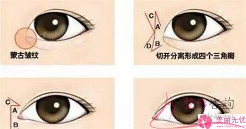 成都實施無痕<a href=http://www.bolangguoji.com/listinfo-711-0.html target=_blank class=infotextkey>開眼角</a>術花多少錢？貴么