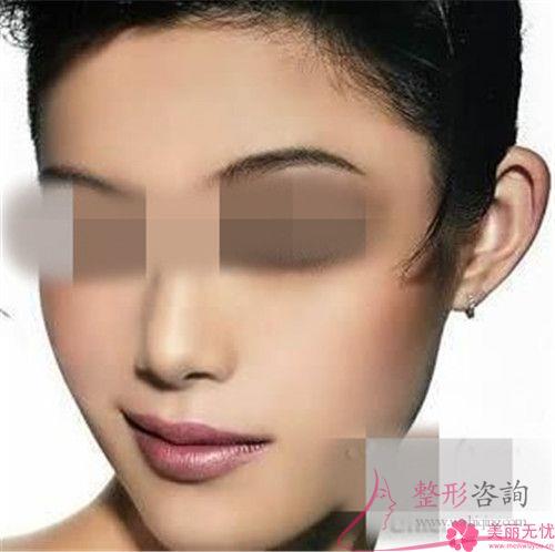 傷口沾水后不利于自體脂肪<a href=http://www.bolangguoji.com/listinfo-694-0.html target=_blank class=infotextkey>豐耳垂</a>后的恢復嗎