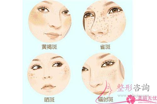 <a href=http://www.bolangguoji.com/listinfo-768-0.html target=_blank class=infotextkey>微針</a>去斑安全性高嗎