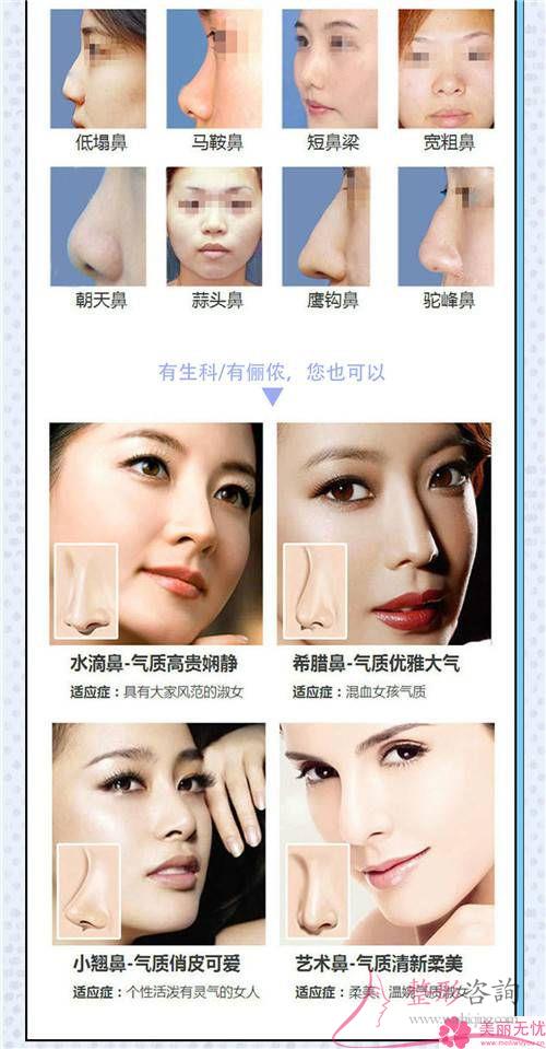 假體<a href=http://www.bolangguoji.com/listinfo-737-0.html target=_blank class=infotextkey>隆鼻</a>效果若何顯現(xiàn)呢
