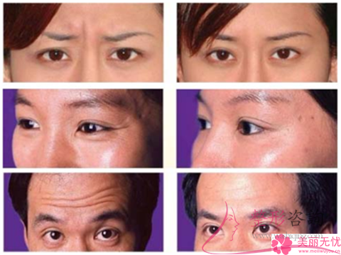 只做一次<a href=http://www.bolangguoji.com/listinfo-610-0.html target=_blank class=infotextkey>熱瑪吉</a>怎么收費？間隙多久二次？