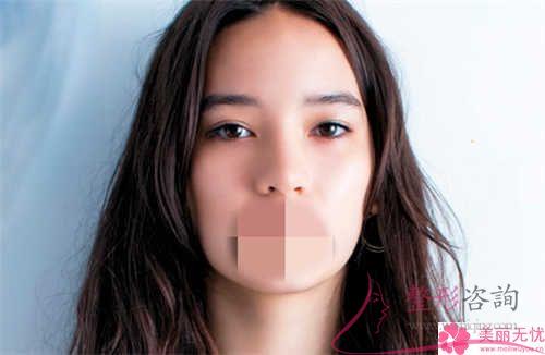 手術(shù)<a href=http://www.bolangguoji.com/listinfo-614-0.html target=_blank class=infotextkey>除皺</a>好久可以變得自然