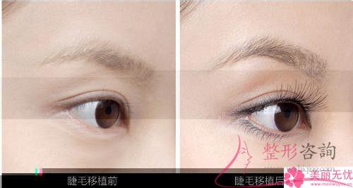 眉毛外觀不美觀的女生美眉是不是得實行線條眉和霧感眉
