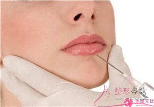 注射<a href=http://www.bolangguoji.com/listinfo-731-0.html target=_blank class=infotextkey>玻尿酸</a>豐唇（Hyaluronic acid enriches lips）到最后5877元夠不夠