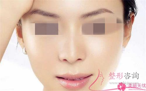 <a href=http://www.bolangguoji.com/listinfo-737-0.html target=_blank class=infotextkey>隆鼻</a>手術后完全恢復需要花多久的時間