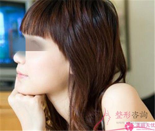 溫州<a href=http://www.bolangguoji.com/listinfo-731-0.html target=_blank class=infotextkey>玻尿酸</a>面部填充<a href=http://www.bolangguoji.com/listinfo-614-0.html target=_blank class=infotextkey>除皺</a>術(shù)手術(shù)費(fèi)用貴嗎