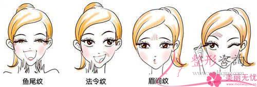平常的<a href=http://www.bolangguoji.com/listinfo-614-0.html target=_blank class=infotextkey>除皺</a>抗衰成效,鋸齒線懸掛去皺方式能不能達到