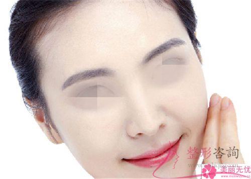 膨體聚四氟乙烯<a href=http://www.bolangguoji.com/listinfo-737-0.html target=_blank class=infotextkey>隆鼻</a>復原時間得要好久？適宜哪些人群？