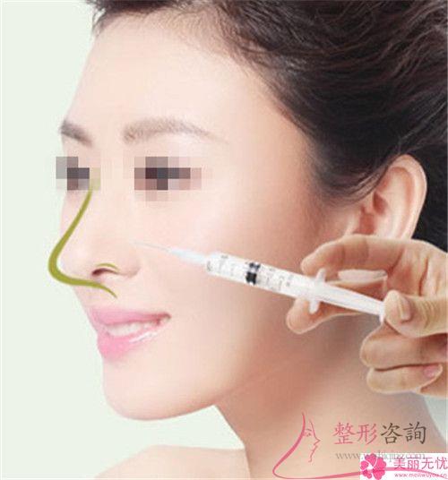 膨體聚四氟乙烯<a href=http://www.bolangguoji.com/listinfo-737-0.html target=_blank class=infotextkey>隆鼻</a>術(shù)靠譜嗎？是否有造成感染？