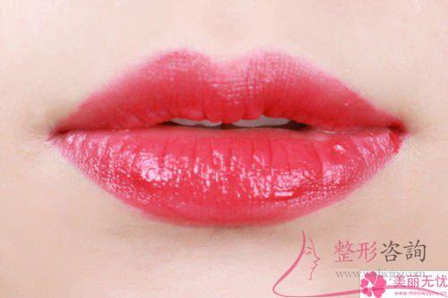 重唇美容術(shù)能夠解決哪些現(xiàn)在