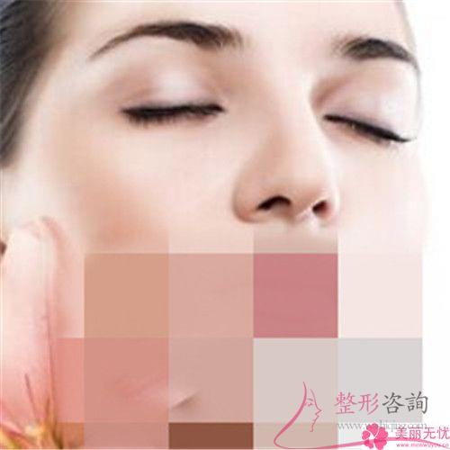 點(diǎn)陣激光祛色斑要經(jīng)歷多久治療周期