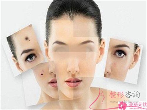 點(diǎn)陣激光祛色斑要經(jīng)歷多久治療周期