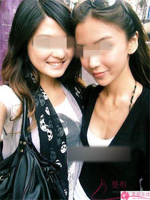 <a href=http://www.bolangguoji.com/listinfo-629-0.html target=_blank class=infotextkey>下頜角</a>截骨手術的費用在12154-21849元之間嗎