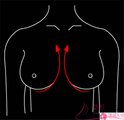女性哺乳后乳暈變大了能不能縮小