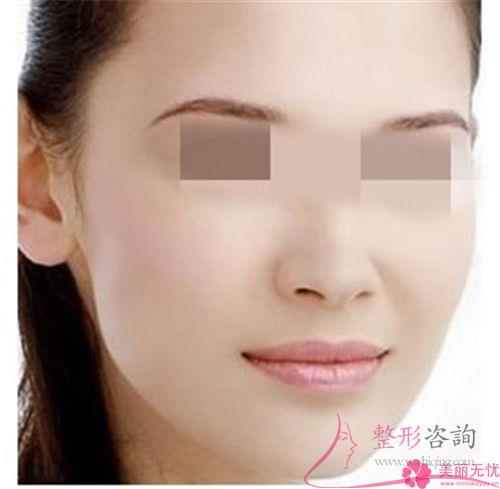 去正規的<a href=http://www.bolangguoji.com/listinfo-4-0.html target=_blank class=infotextkey>整形醫院</a>做<a href=http://www.bolangguoji.com/listinfo-731-0.html target=_blank class=infotextkey>玻尿酸</a>豐面頰手術安全嗎