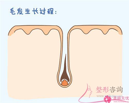 做一次E光永久<a href=http://www.bolangguoji.com/listinfo-670-0.html target=_blank class=infotextkey>脫毛</a>要花多少錢