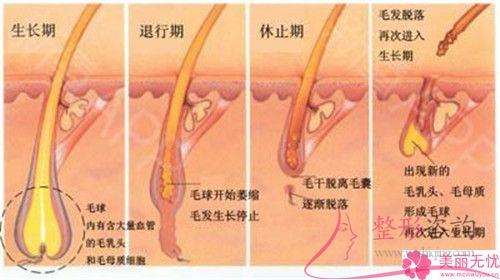 做一次E光永久<a href=http://www.bolangguoji.com/listinfo-670-0.html target=_blank class=infotextkey>脫毛</a>要花多少錢