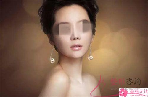 <a href=http://www.bolangguoji.com/listinfo-737-0.html target=_blank class=infotextkey>隆鼻</a>術(shù)整形效果有哪些