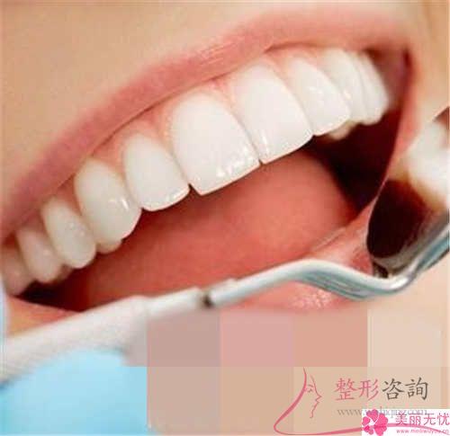 牙齒修復顆牙齒要準備多少？