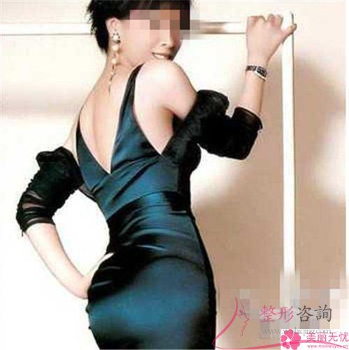 超聲臀部減脂的兩大優勢