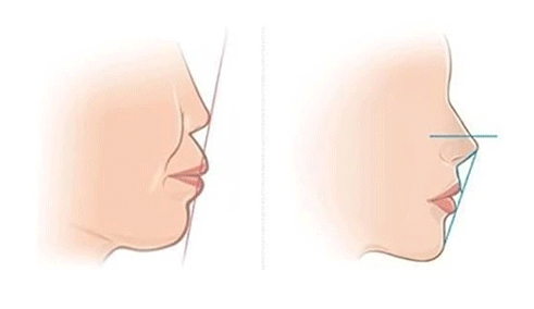 1007365563