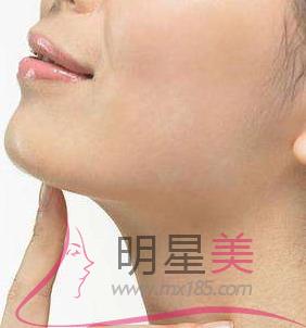 <a href=http://www.bolangguoji.com/listinfo-635-0.html target=_blank class=infotextkey>去頰脂墊</a>為什么沒效果