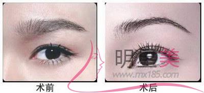 成都<a href=http://www.bolangguoji.com/listinfo-657-0.html target=_blank class=infotextkey>繡眉</a>哪里比較好
