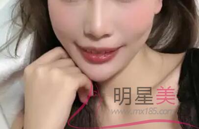 臉上長(zhǎng)小紅疙瘩帶白頭