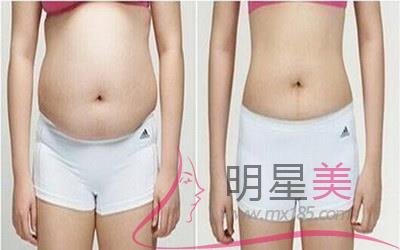 注射<a href=http://www.bolangguoji.com/listinfo-631-0.html target=_blank class=infotextkey>瘦臉</a>手術醫院