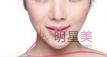 自體脂肪<a href=http://www.bolangguoji.com/listinfo-643-0.html target=_blank class=infotextkey>豐額頭</a>恢復期多久