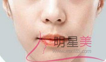 額頭長個肉刺怎么去除