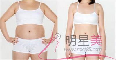 水動(dòng)力<a href=http://www.bolangguoji.com/listinfo-685-0.html target=_blank class=infotextkey>吸脂</a>手術(shù)的原理