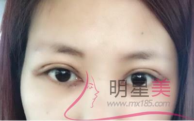 臉上全是白色小顆粒怎么回事