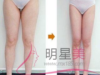 最有效<a href=http://www.bolangguoji.com/listinfo-684-0.html target=_blank class=infotextkey>瘦大腿</a>內側