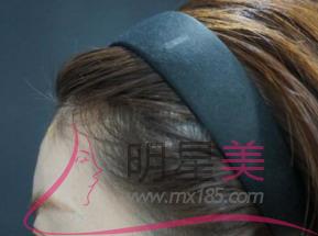 <a href=http://www.bolangguoji.com/listinfo-630-0.html target=_blank class=infotextkey>豐太陽穴</a>的收費