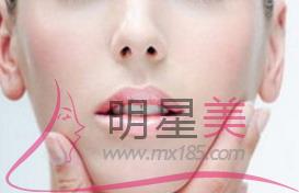 北京自體<a href=http://www.bolangguoji.com/listinfo-630-0.html target=_blank class=infotextkey>豐太陽(yáng)穴</a>