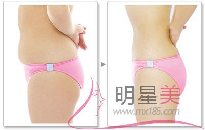 水動力<a href=http://www.bolangguoji.com/listinfo-685-0.html target=_blank class=infotextkey>吸脂</a>的原理