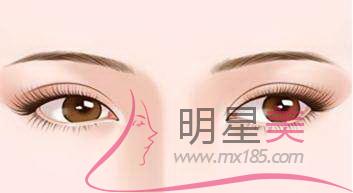 煤炭總醫(yī)院整形紋眉